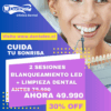 CYBER BLANQUEAMIENTO DENTAL LED - Imagen 2