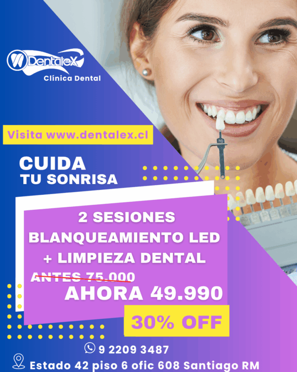 CYBER BLANQUEAMIENTO DENTAL LED