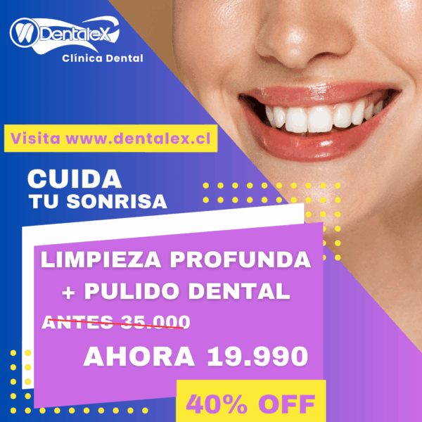 Limpieza Dental Profunda Promoción CYBER