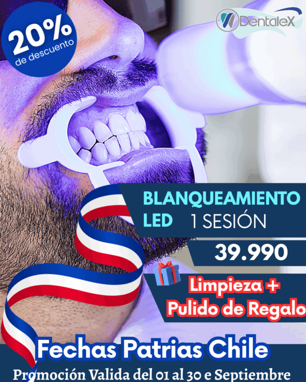 Blanqueamiento Dental Led 1 sesión + Limpieza Dental y Pulido de Regalo
