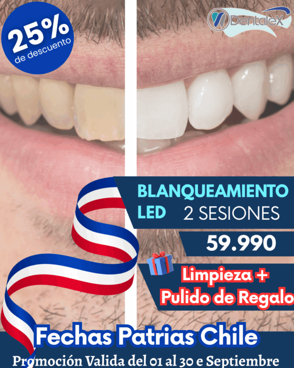 Blanqueamiento Dental Led 2 sesiones + Limpieza Dental y Pulido de Regalo